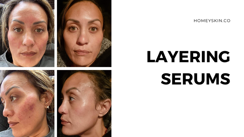 Layering Serums Technique